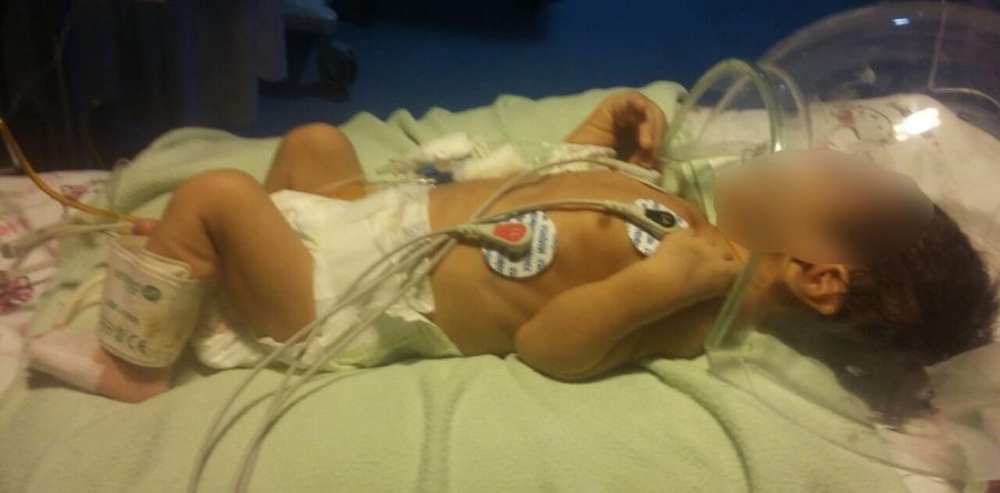 Eliel se debate entre la vida y la muerte; requiere de una operación que sólo se realiza en la CDMX