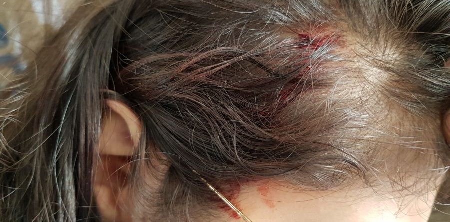 Heridos y daños materiales dejan 17 horas de bloqueos en Oaxaca