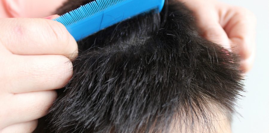 En temporada de frío evita la pediculosis: SSO