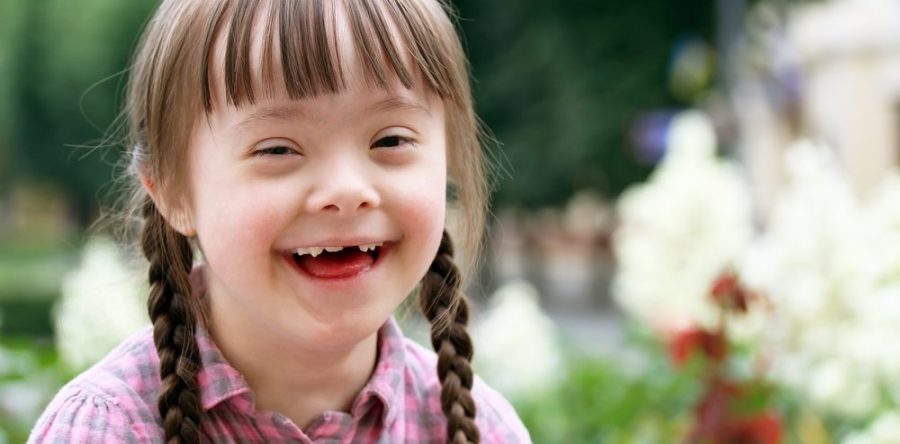 Síndrome de Down, alteración cromosómica que no debe excluirse socialmente: SSO