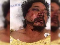 Condena Gobierno del Estado ataque a migrante oaxaqueño en EE.UU