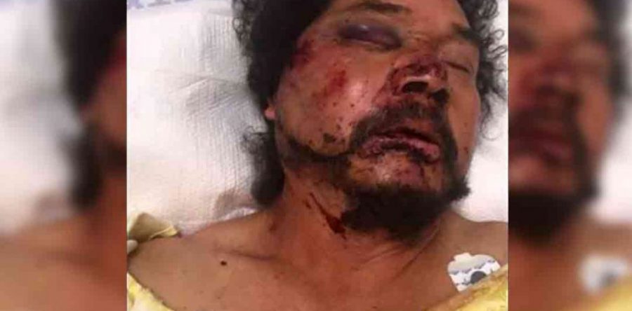 Condena Gobierno del Estado ataque a migrante oaxaqueño en EE.UU