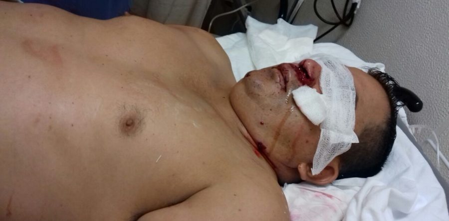 Fallece uno de los dos profesores baleados en Ciudad Ixtepec