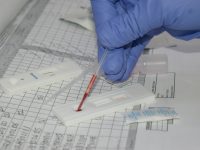 Estrategia 90 – 90 – 90, una respuesta mundial al VIH