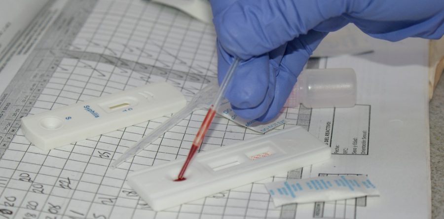 Estrategia 90 – 90 – 90, una respuesta mundial al VIH