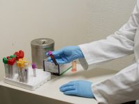 Oaxaca, noveno lugar en VIH a nivel nacional