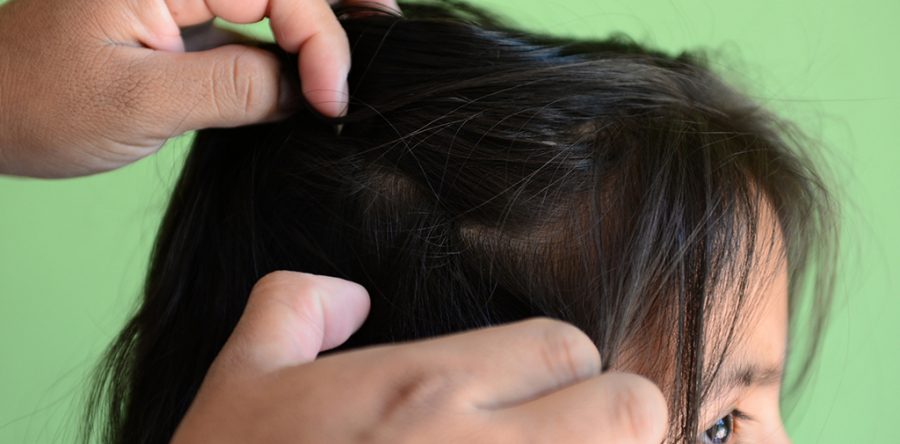 Revisión constante para detectar brotes de piojos: SSO