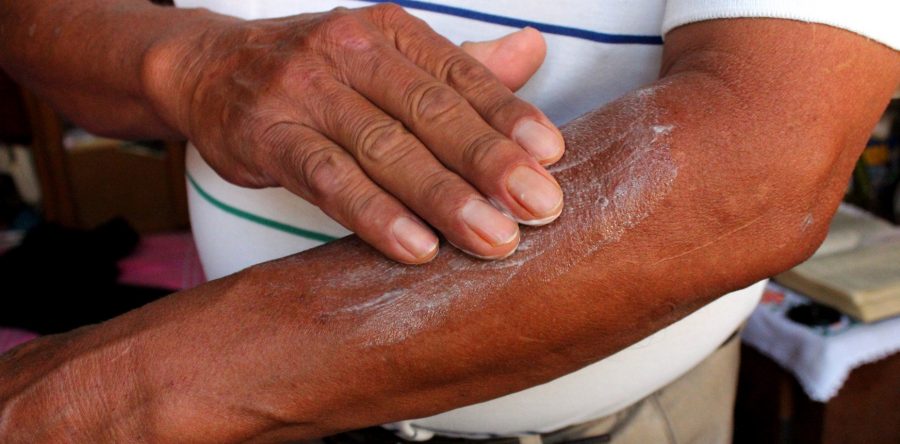 Dan a conocer medidas preventivas para evitar  golpe de calor
