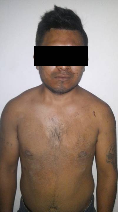 Recupera Policía Estatal vehículo robado y detiene a una persona acusada de robo