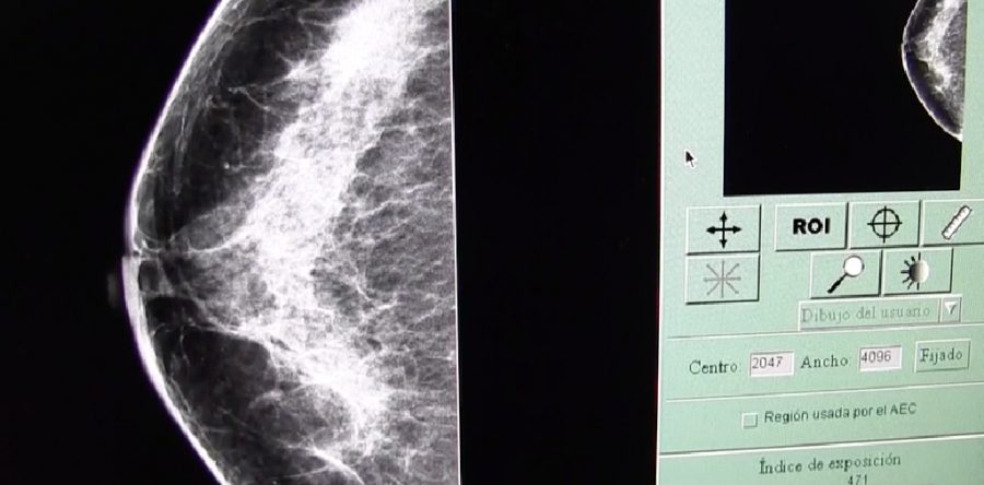 Promueve SSO la autoexploración como medida fundamental contra el cáncer de mama