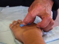 Alertan sobre Hemofilia en varones