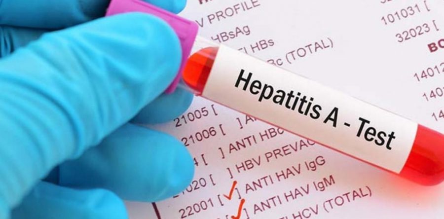 Atiende SSO casos de Hepatitis “A”