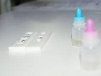 Sífilis es curable si se detecta en etapas tempranas: Coesida