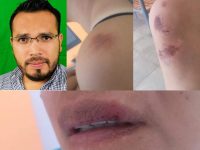 Santa Lucía del Camino, protagonista de violencia de género; propina exfuncionario 17 golpes a una mujer
