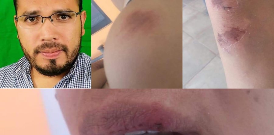 Santa Lucía del Camino, protagonista de violencia de género; propina exfuncionario 17 golpes a una mujer