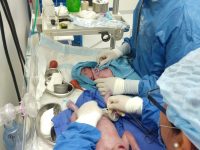 Nacen los primeros gemelos en el Hospital General de Juchitán