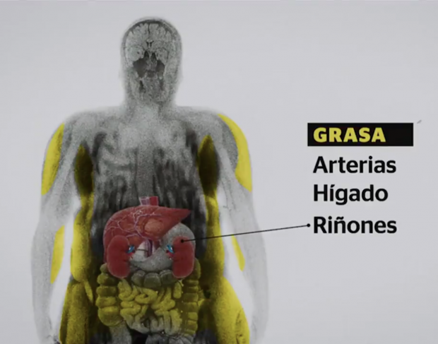 Epidemia de obesidad alcanza a los niños mexicanos: 32% tienen sobrepeso