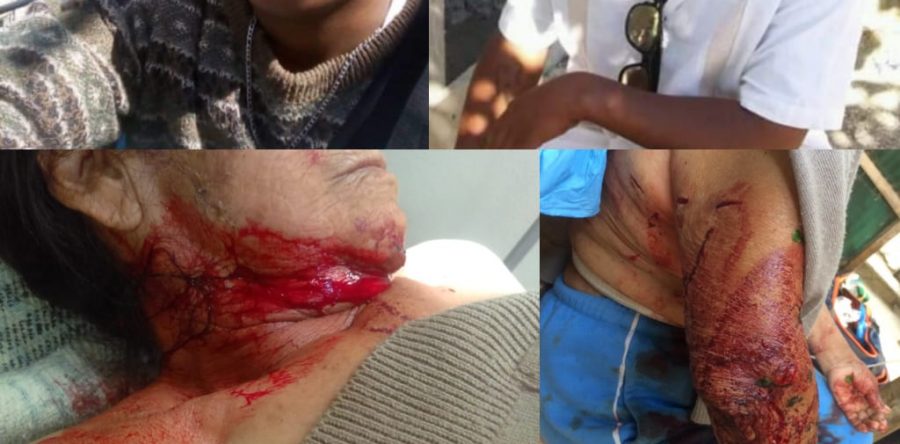 Atacan a navajazos a mujer de la tercera edad en Xoxo