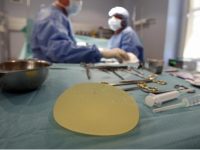 Implantes mamarios de Microcell no representan riesgo: Cofepris