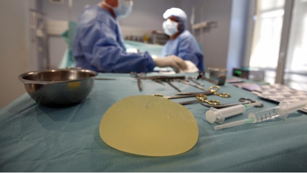 Implantes mamarios de Microcell no representan riesgo: Cofepris