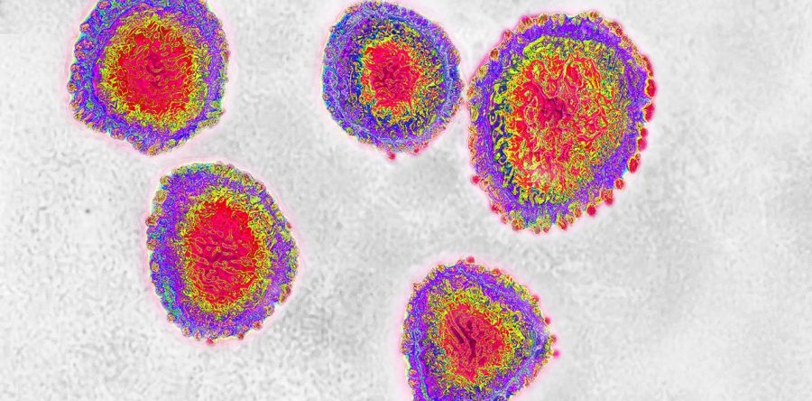 Confirman primer positivo de coronavirus Covid-19 en México