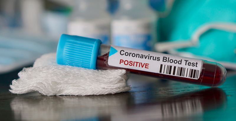 Aplican  Sector Salud Estatal y Federal plan epidemiológico por probable caso de coronavirus