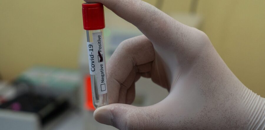 Nueva cepa no causa una enfermedad más severa: estudio británico