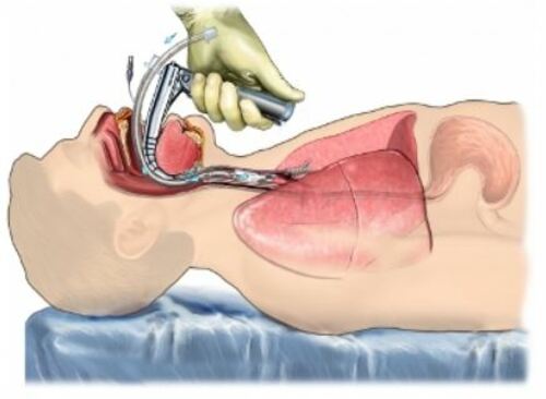 ¿Es negocio, o es salud?: Horacio Corro Espinosa