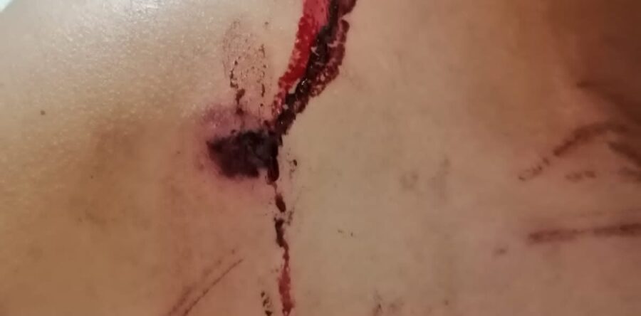 Balazos con abrazos y votos ensangrentados: Alfredo Martínez de Aguilar