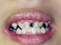 Restaurar salud dental a niños, propuesta de Sonrisas y #UNO: Alfredo Martínez de Aguilar