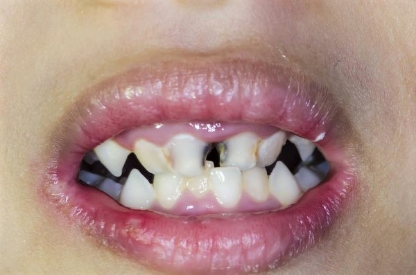 Restaurar salud dental a niños, propuesta de Sonrisas y #UNO: Alfredo Martínez de Aguilar