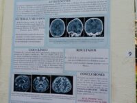 Presentan casos clínicos exitosos en el ISSSTE