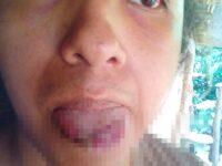 David Merino víctima de la transfobia pide castigo para quien le cortó la mitad de la lengua