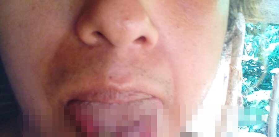 David Merino víctima de la transfobia pide castigo para quien le cortó la mitad de la lengua