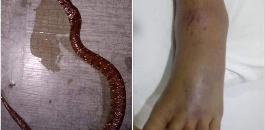 Una niña en Río Grande sufre mordedura de serpiente venenosa