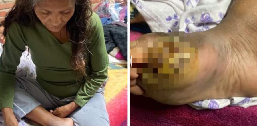 Piden apoyo económico para Edmunda García